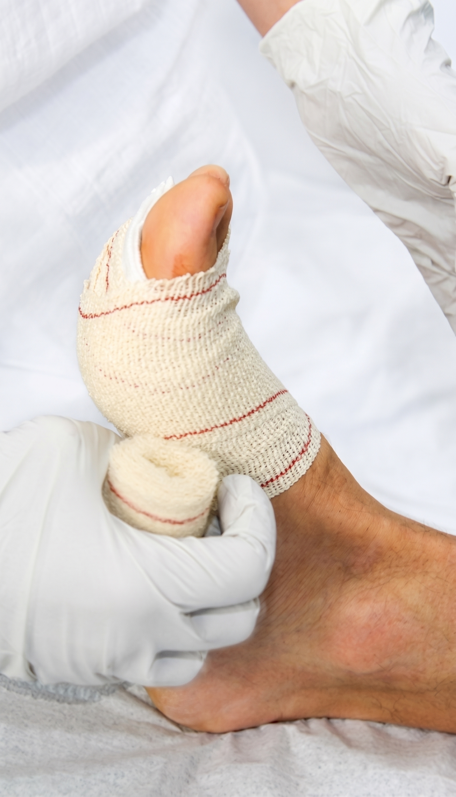 A wound care dressing being applied to a patient's foot